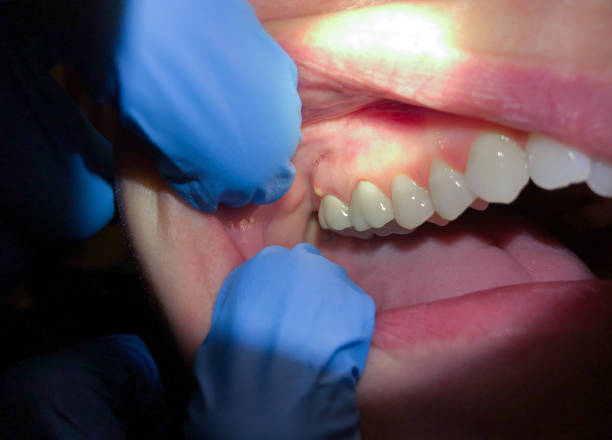 Best Emergency Dental Surgery in Meade, KS