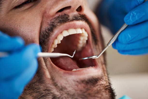 Best Emergency Broken Tooth Repair in Meade, KS