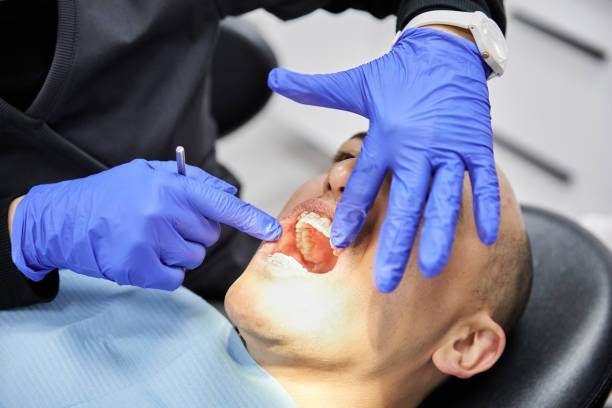 Best Emergency Root Canal Treatment in Meade, KS